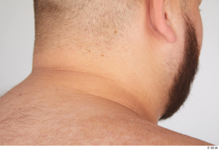 Ronaldo Biggato neck nude 0006.jpg